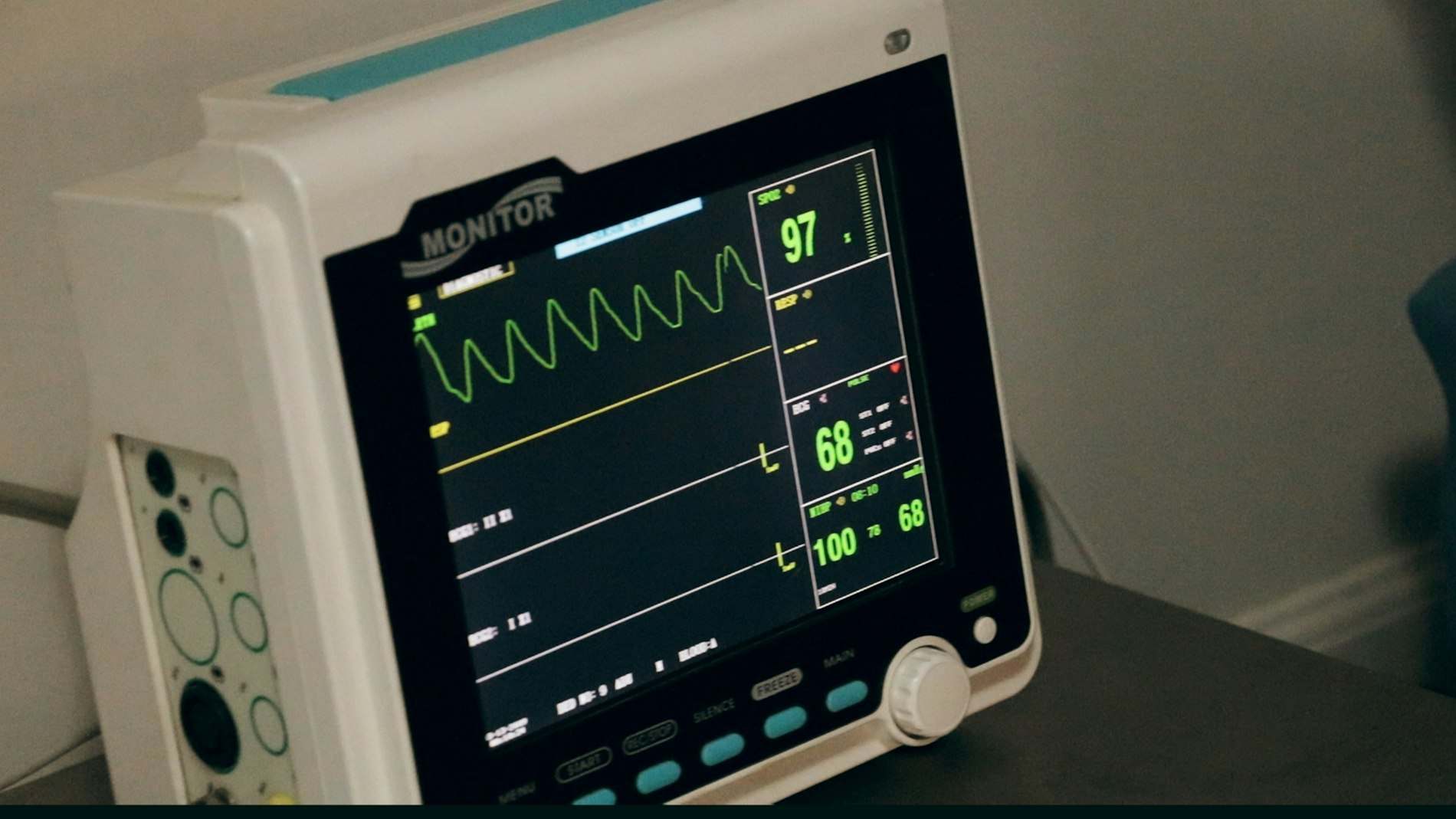 Monitor de sinais vitais mostrando traçado de batimento cardíaco